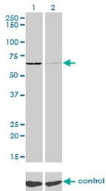 SARS Antibody in Western Blot (WB)