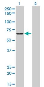 SARS Antibody in Western Blot (WB)