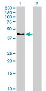 SERPINB3 Antibody in Western Blot (WB)