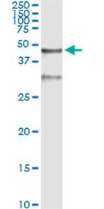 SERPINB3 Antibody in Immunoprecipitation (IP)