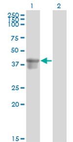 SERPINB3 Antibody in Western Blot (WB)