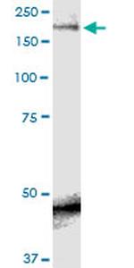 SCN9A Antibody in Western Blot (WB)