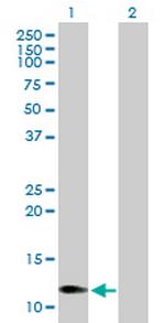 CCL1 Antibody in Western Blot (WB)