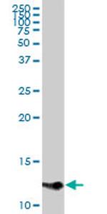 CCL1 Antibody in Western Blot (WB)