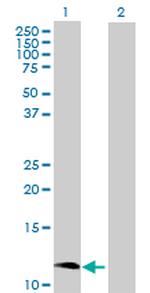 CCL1 Antibody in Western Blot (WB)