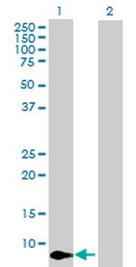 CXCL11 Antibody in Western Blot (WB)