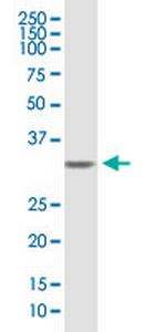 SDCBP Antibody in Western Blot (WB)