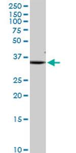 SDHB Antibody in Western Blot (WB)