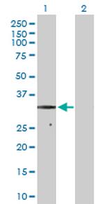 SDHB Antibody in Western Blot (WB)