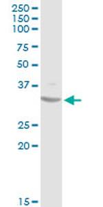 SDHB Antibody in Western Blot (WB)