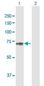 SEMG2 Antibody in Western Blot (WB)