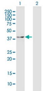 MAP2K4 Antibody in Western Blot (WB)