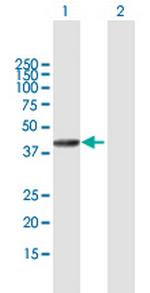 SETMAR Antibody in Western Blot (WB)