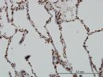 SGK Antibody in Immunohistochemistry (Paraffin) (IHC (P))