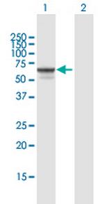 SGSH Antibody in Western Blot (WB)