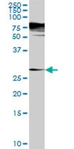 SGTA Antibody in Western Blot (WB)