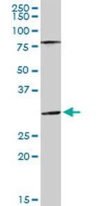 SGTA Antibody in Western Blot (WB)