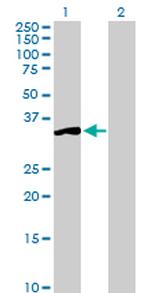 SGTA Antibody in Western Blot (WB)