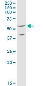 SHMT2 Antibody in Western Blot (WB)