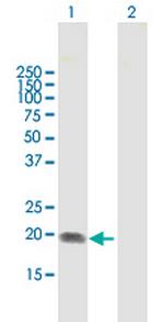 ST6GAL1 Antibody in Western Blot (WB)