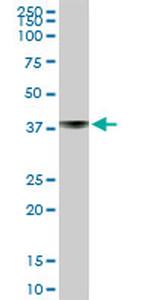 ST6GAL1 Antibody in Western Blot (WB)