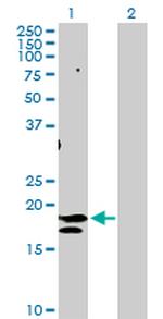 ST6GAL1 Antibody in Western Blot (WB)