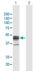 ST3GAL1 Antibody in Western Blot (WB)