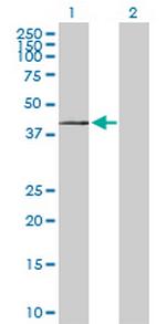 ST3GAL1 Antibody in Western Blot (WB)