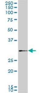 SIX3 Antibody in Western Blot (WB)