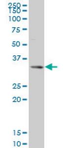 SIX3 Antibody in Western Blot (WB)