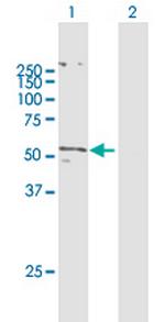 SLC2A5 Antibody in Western Blot (WB)