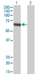 SLC5A2 Antibody in Western Blot (WB)