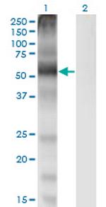 SLC7A1 Antibody in Western Blot (WB)