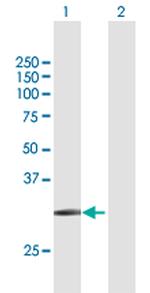 SLC14A1 Antibody in Western Blot (WB)