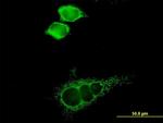 SLC16A1 Antibody in Immunocytochemistry (ICC/IF)