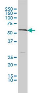 SLC18A1 Antibody in Western Blot (WB)