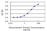 SLC22A2 Antibody in ELISA (ELISA)