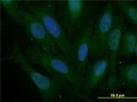 SNAI2 Antibody in Immunocytochemistry (ICC/IF)