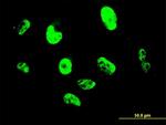 SNAI2 Antibody in Immunocytochemistry (ICC/IF)