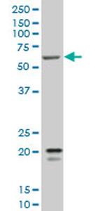 SMARCD3 Antibody in Western Blot (WB)