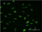 SMN2 Antibody in Immunocytochemistry (ICC/IF)