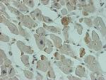 SMN2 Antibody in Immunohistochemistry (Paraffin) (IHC (P))