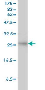 SMN2 Antibody in Western Blot (WB)