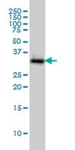 SMN2 Antibody in Western Blot (WB)