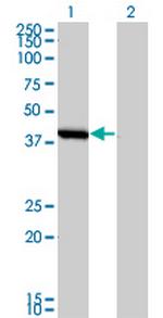 SMS Antibody in Western Blot (WB)