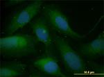 SNAI1 Antibody in Immunocytochemistry (ICC/IF)