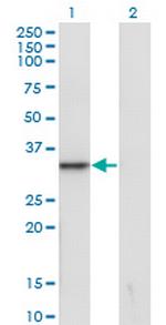 SNAI1 Antibody in Western Blot (WB)