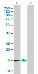 SNCA Antibody in Western Blot (WB)