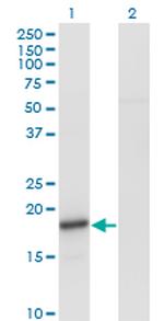 SNCA Antibody in Western Blot (WB)