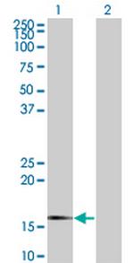 SNCG Antibody in Western Blot (WB)